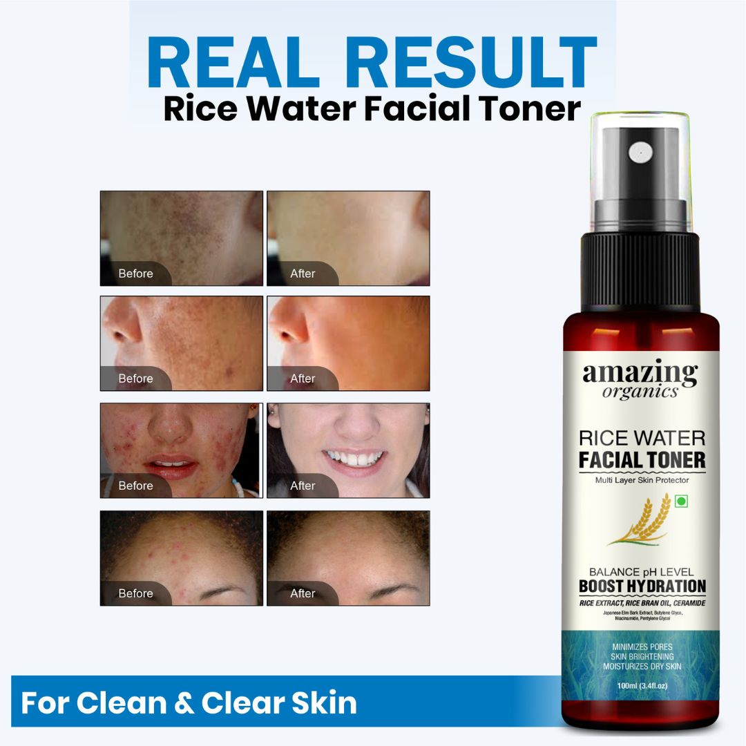 Rice Water Facial Toner
