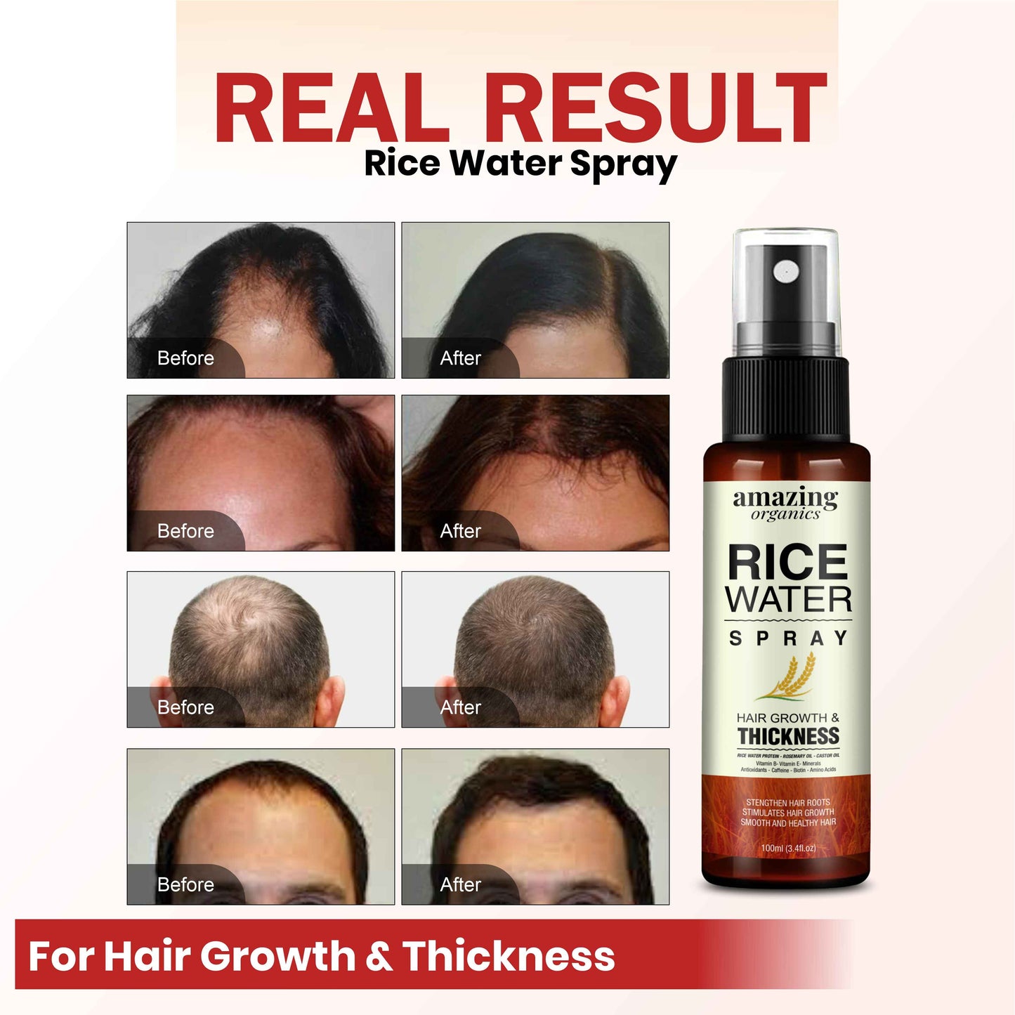 Rice Water For Hair Growth