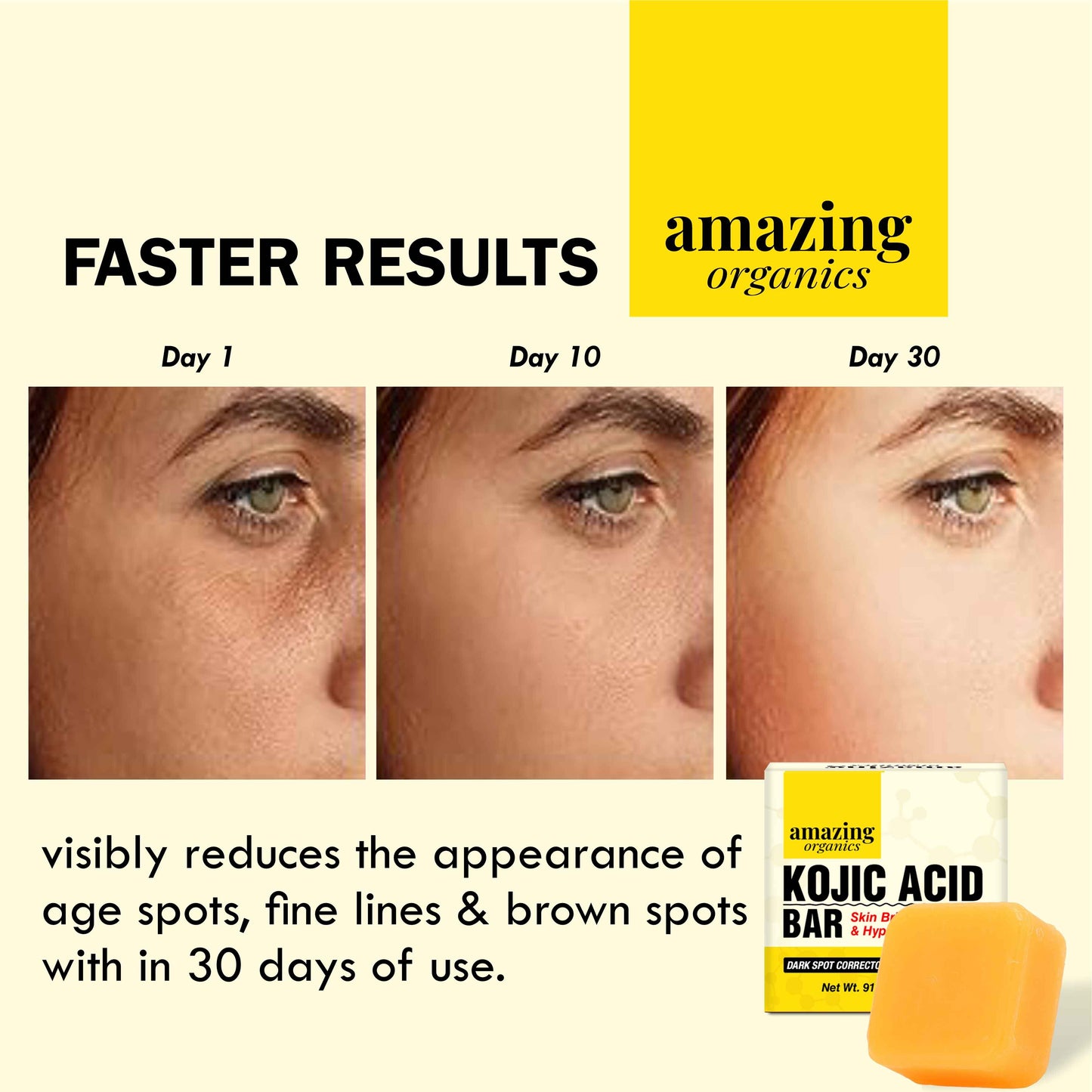 Kojic Acid Bar - Skin Brightening