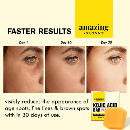 Kojic Acid Bar - Skin Brightening