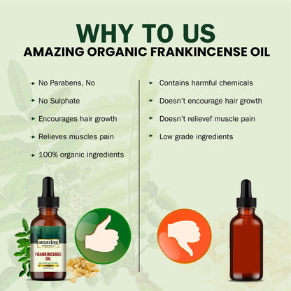 Frankincense Essential Oil