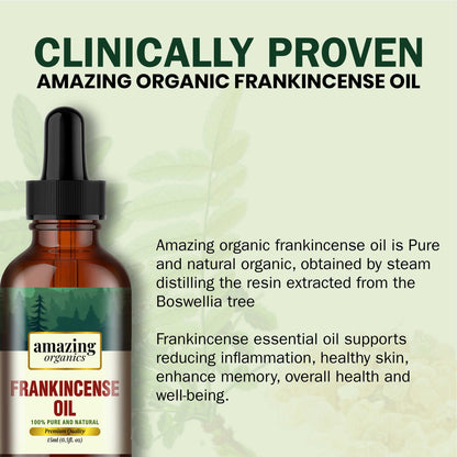 Frankincense Essential Oil Certified Organic